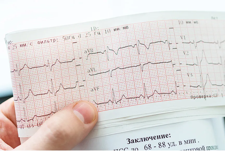ecg-paper3